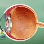 Boehringer Ingelheim and Re-Vana Partner to Develop First-in-Class Ocular Therapies