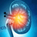 YolTech's YOLT-203 Gains Orphan Drug Designation for Primary Hyperoxaluria Type 1 Treatment