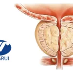 Hengrui Receives Clinical Clearance for HRS-5041 in Prostate Cancer Treatment