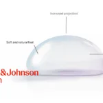 J&J MedTech Gains China Approval for MENTOR MemoryGel Xtra Breast Implants
