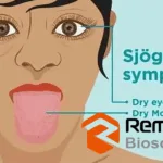 RemeGen Announces Positive Phase III Results for Telitacicept in Primary Sjögren's Syndrome