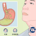 Livzon Announces NMPA Acceptance of JP-1366 Tablets Application for Reflux Esophagitis