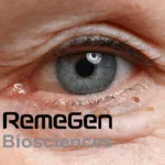 RemeGen Inks Licensing Deal With Santen China for RC28-E Eye Disease Drug