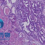 Haihe Biopharma Seeks Japan Approval for Risovalisib in PIK3CA-Mutated Ovarian Cancer
