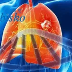 Abbisko's ABSK043 Gains IND Approval for KRAS G12C NSCLC in Partnership with Allist