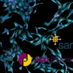 Jazz Pharmaceuticals Secures Global Rights to Saniona's Epilepsy Drug SAN2355