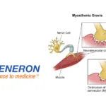 Regeneron’s Cemdisiran Beats Key Milestones in Phase III gMG Trial