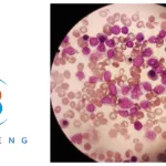 Bioheng Therapeutics Receives FDA RPDD for Off‑The‑Shelf CAR‑T CTD402