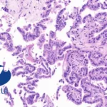 Hengrui Pharma Secures NMPA Approval for HRS‑7172 Targeting RAS‑Mutated Tumors