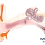 Boji Medical’s FCZR Approved for Otomycosis Trials – First Liquid Eardrop in China