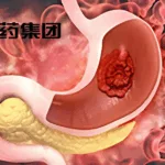 CSPC Pharmaceutical Group Submits Anbenitamab for NMPA Approval in HER2‑Positive Gastric Cancer