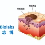Nanjing Leads Biolabs Doses First Patient in Opamtistomig Melanoma Trial