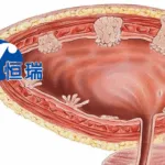 Hengrui Pharma Secures Breakthrough Therapy Designation for SHR‑1501 in China