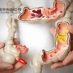 Huadong Medicine Secures FDA IND Approval for HDM2017 ADC