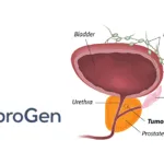 FibroGen Launches Phase 2 Dose‑Optimization Trial for CD46‑Targeted ADC FG‑3246 in Metastatic Castration‑Resistant Prostate Cancer