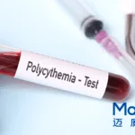 Mabwell Bioscience Hits Phase II Milestone with First‑Patient Dose of 9MW3011, the Only Anti‑TMPRSS6 Monoclonal Antibody for Polycythemia Vera