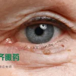 Xingqi Pharma Secures NMPA Approval for SQ‑129, a Novel Treatment for Diabetic Macular Edema