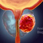 Kexing Biopharm & Easton Biopharma Sign Exclusive Overseas Licensing Deal for Apalutamide