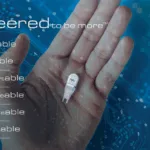 Boston Scientific Announces Nalu Medical Acquisition to Expand Chronic‑Pain Portfolio