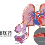 Humanwell Healthcare Secures NMPA Approval to Launch First Fixed‑Dose Combination for Pulmonary Arterial Hypertension