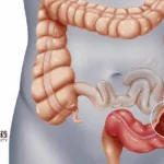 Hangzhou Bio‑Sincerity Secures NMPA Approval for BIOS‑0625 Tablet – First‑in‑Class Ulcerative Colitis Therapy