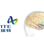 NMPA Grants Marketing Authorisation to Hefei Amvite’s Memantine Hydrochloride ODT for Alzheimer’s Disease