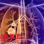 Zhejiang Jianfeng Group Secures NMPA Approval for JFAN‑1001/ Vinorelbine Combination in Advanced NSCLC