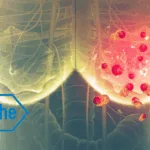 Roche's giredestrant SERD Achieves iDFS Win in Phase 3 lidERA Breast Cancer Trial