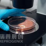 Reprogenix Closes RMB 500M Series A+ to Advance Diabetes Cell Therapy Pipeline