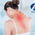 Hengrui's Ivarmacitinib NDA Accepted for Non‑Radiographic Axial Spondyloarthritis