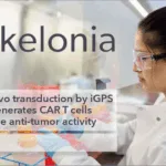 Kelonia JNJ Partnership Targets In Vivo CAR-T for Multiple Myeloma