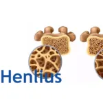Henlius HLX14 Denosumab Biosimilar NDA Accepted by China CDE