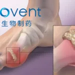 Innovent Doses First Patient in Phase 1 Trial of IBI3011, China’s First Anti‑IL‑1RAP Antibody for Gout Flares