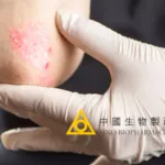 Sino Biopharmaceutical's TQH3906 Achieves 90% PASI 75 Response in Phase 2 Psoriasis Trial