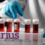 Sirius Therapeutics Doses First Phase II Patient for SRSD216 siRNA Hyperlipoproteinemia Therapy