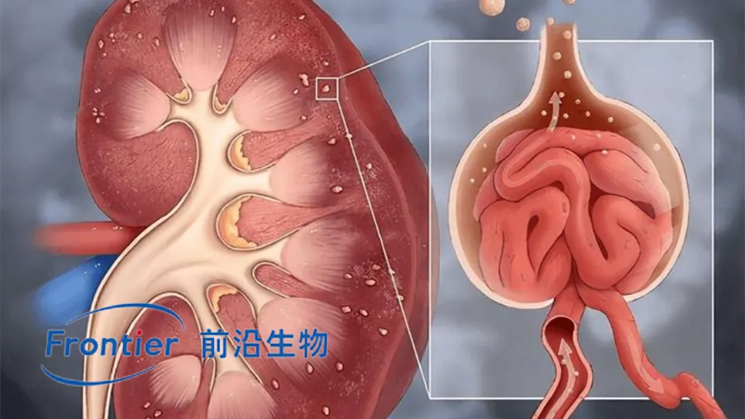 Frontier Biotech's FB7013 Wins NMPA IND for MASP‑2 siRNA in IgA Nephropathy