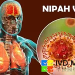 IVD Medical Launches Nipah Virus Detection Kit with AI Early Warning Platform