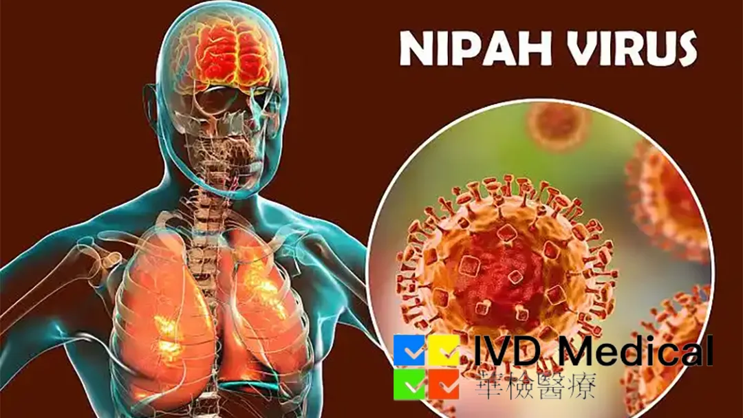 IVD Medical Launches Nipah Virus Detection Kit with AI Early Warning Platform