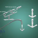 Peijia Medical Doses First Patient in US Early Feasibility Study for GeminiOne TEER System – Expands Global Mitral Regurgitation Pipeline