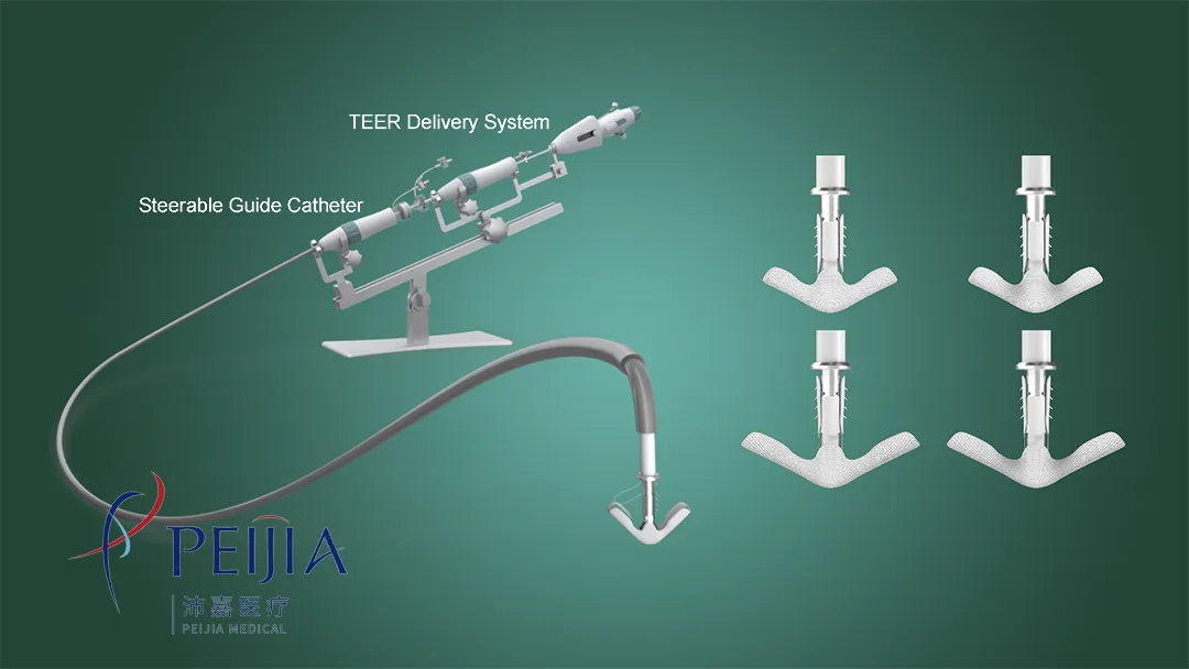 Peijia Medical Doses First Patient in US Early Feasibility Study for GeminiOne TEER System – Expands Global Mitral Regurgitation Pipeline