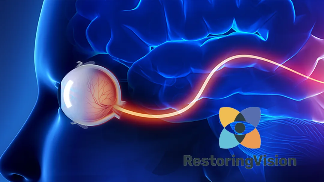 Shionogi Launches Corporate Venture Capital Initiative with Strategic Investment in Ophthalmology Startup Restore Vision