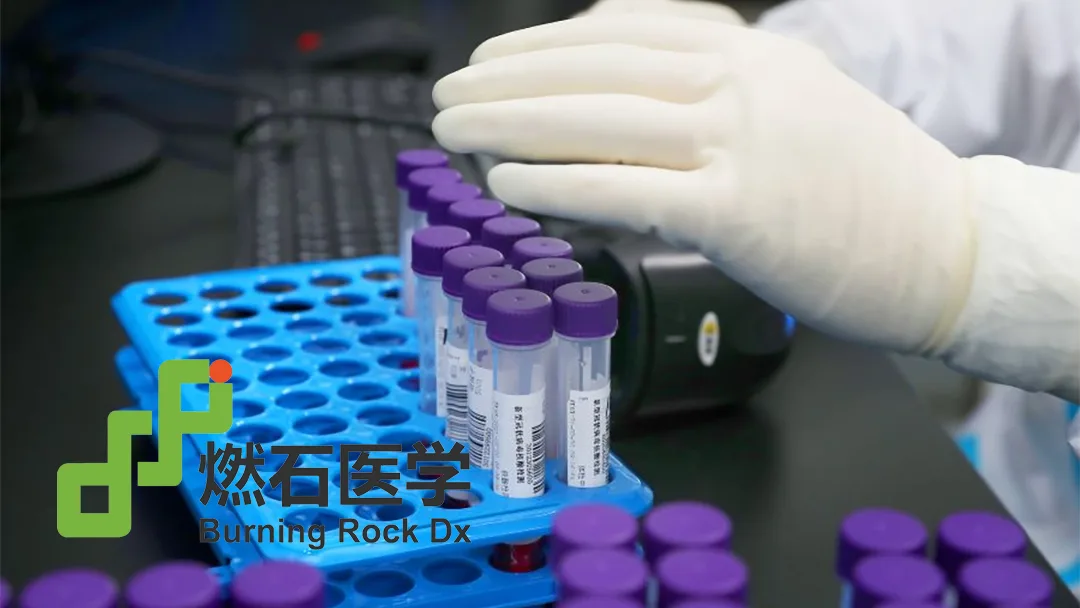 Burning Rock Reports Q1 2026 Revenue of $16M, Accelerates Strategic Shift to In-Hospital Testing with 49% Revenue Share