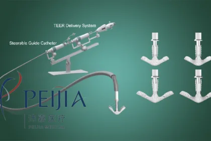 Peijia Medical Wins NMPA Approval for GeminiOne TEER System – A Novel Transcatheter Edge‑to‑Edge Repair Device for Mitral Regurgitation in China