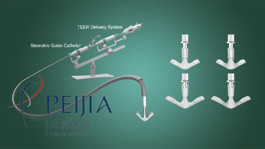 Peijia Medical Wins NMPA Approval for GeminiOne TEER System – A Novel Transcatheter Edge‑to‑Edge Repair Device for Mitral Regurgitation in China