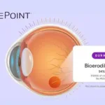 EyePoint's DURAVYU Misses Primary Endpoint in Phase III LUCIA Trial for Wet AMD – Non‑Inferiority vs. Aflibercept Not Achieved; Key Secondary Endpoints Met