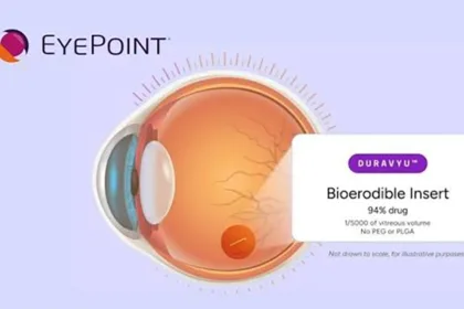 EyePoint's DURAVYU Misses Primary Endpoint in Phase III LUCIA Trial for Wet AMD – Non‑Inferiority vs. Aflibercept Not Achieved; Key Secondary Endpoints Met