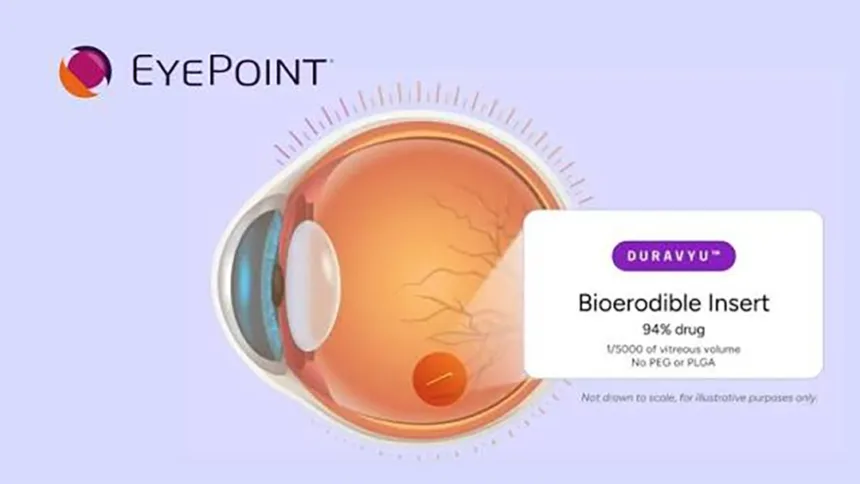 EyePoint's DURAVYU Misses Primary Endpoint in Phase III LUCIA Trial for Wet AMD – Non‑Inferiority vs. Aflibercept Not Achieved; Key Secondary Endpoints Met