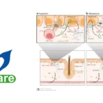 Jiangsu Vcare's VC005 JAK1 Inhibitor Wins CDE IND Approval for Seborrheic Dermatitis – Fourth Topical Indication for Next‑Generation Molecule
