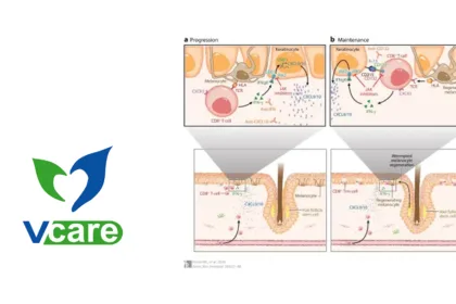 Jiangsu Vcare's VC005 JAK1 Inhibitor Wins CDE IND Approval for Seborrheic Dermatitis – Fourth Topical Indication for Next‑Generation Molecule